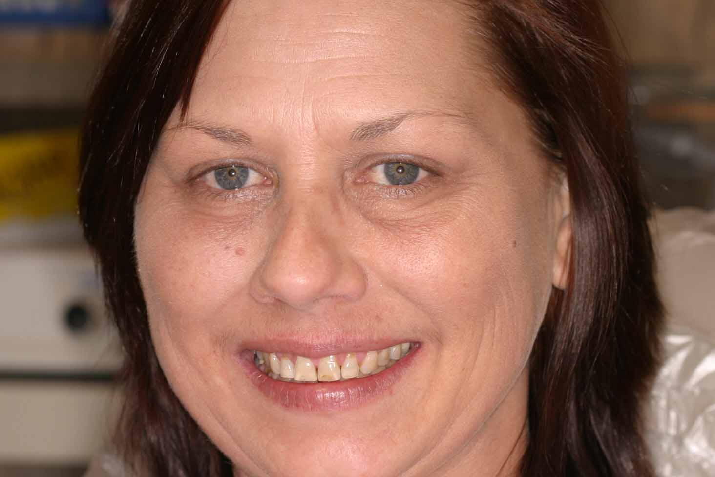 Cosmetic Dentist Fort Myers Cape Coral Naples FL